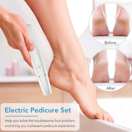 💥Limited time Offer 60%OFF🔥⚡Electric Feet Callus Remover