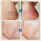 🔥Winter Hot Sale 49%OFF- Hydrating and Anti-Cracking Foot Cream(Autumn/Winter Essential)
